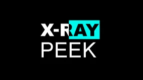 X-Ray Peek